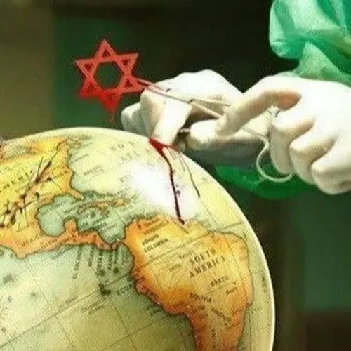 ایران در حال درمان سرطان جهود کودک کش در فلسطین اشغالی 👊🏽
