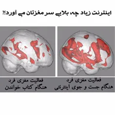 اینترنت زیاد چه بلایی سر مغزتان می‌آورد ؟