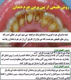 جرم گیری طبیعی دندانها