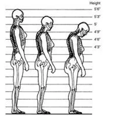 قد انسان بعد از 30 سالگی به ازای هر ده سال 1.27 سانتی متر