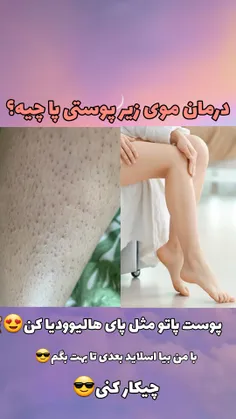 قیمت پک کامل تو پیجمون موجود هست🥰