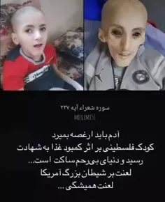 # غزه