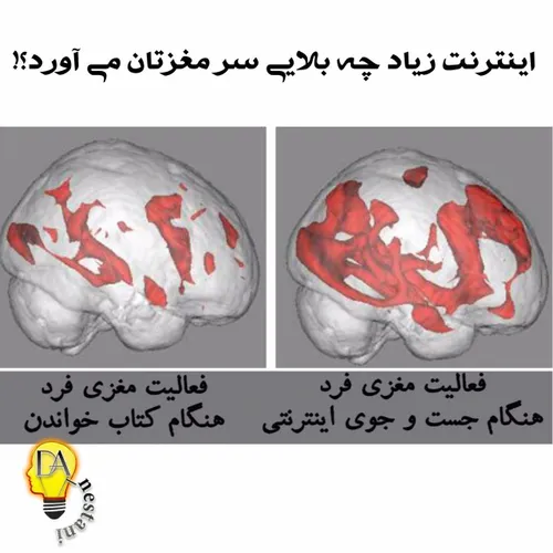 ▪ ️اینترنت زیاد چه بلایی سر مغزتان می آورد ؟