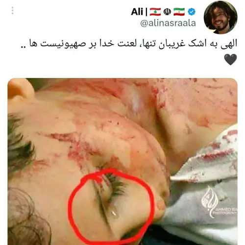 لعنت خدا بر صهیونیست ها 💔