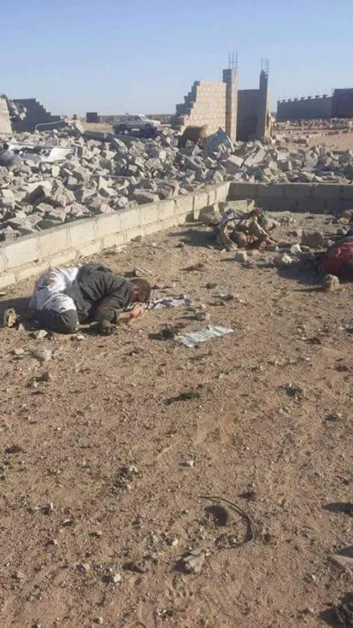 تصاویر دلخراش از بمباران مردم مظلوم یمن توسط دشمن صهیونیس