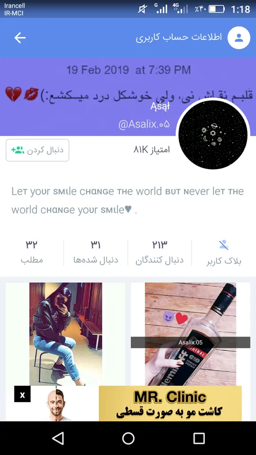 لایکوفالوشه❤