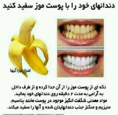 🍌 موز و دیگر هیچ 😉 خوراکی هنر خلاقیت زرد ایده بخون