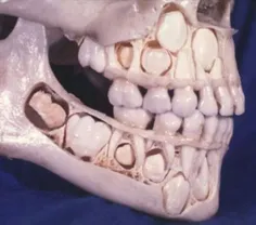 انتومی فک دندان انسان قبل از هفت سالگی...خخ