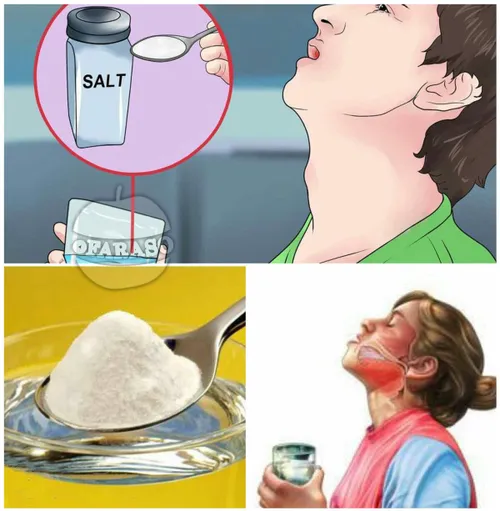 غرغره کردن با آب نمک به شما کمک می کند تا از شر خلط ها که