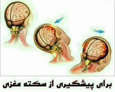 راه های پیشگیری از سکته مغزی: