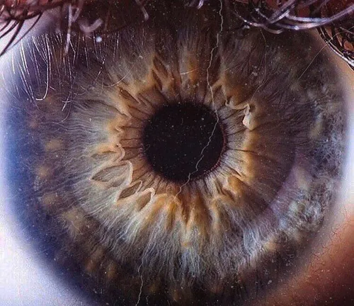 eye