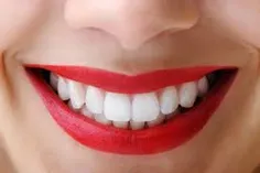 دندان تو هم این شکلیه