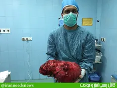 جراحی بزرگترین تومور کلیه 8 کیلویی جهان +عکس و فیلم

