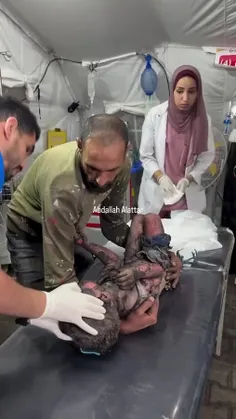 این کودک غزه در آتش بمب های آمریکایی توسط رژیم کودک کش صه