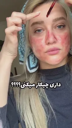 آموزش لایه برداری عمیق پوست***