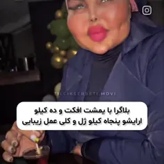 مامانم با کتک های آب داری که بهم زده تعصب داره به اینا😅😒