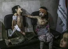 کودک سوری بهت زده از ترس و زخم و درد و ویرانی