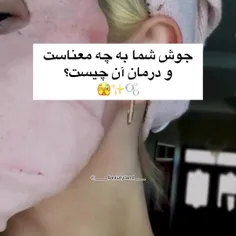 جوش شما به چه معناست؟🎀💗