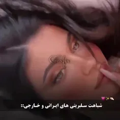 پشمام🧐