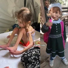 📸 قبل و بعد دختربچه فلسطینی! 
