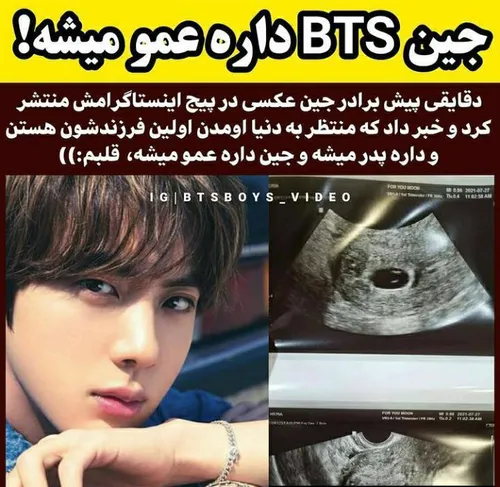 به به مبارک امیدوارم ی قسمتش ب جین بره😂🦋💜