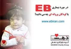 «اپیدرمولیز بولوسا» - Epidermolysis Bullosa - با نام مخفف