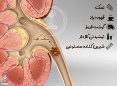 موادی که با مصرف زیاد باعث ایجاد سنگ‌ کلیه خواهند شد❗ ️