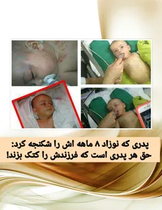 پدری که نوزاد 8 ماهه اش را شکنجه کرد: حق هر پدری است که ف
