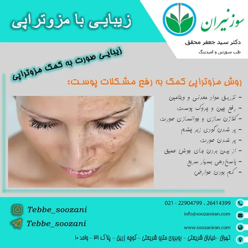 💢 روش مزوتراپی