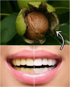 سابیدن پوست سبز گردو، در کمتر از ۵ دقیقه دندانهای شما را 