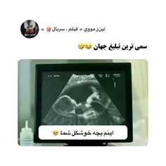 باور میکنید این تبلیغه🤣🤣