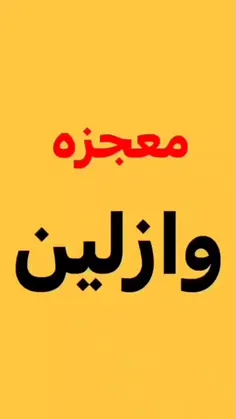 زیبایی 