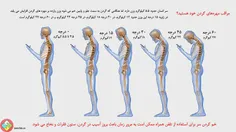 آسیب موبایل به ستون فقرات . . . 