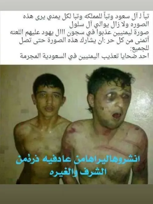 وضعیت زندانیان یمنی در زندان های آل سعود!