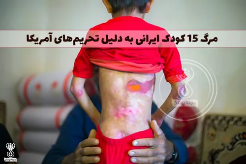 هشدار حاوی صحنه دلخراش،مرگ ۱۵ کودک ایرانی به دلیل تحریم ه