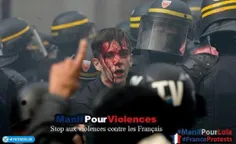 از ابتدای شروع تظاهرات در فرانسه، ۶۵۰ نفر کشته و ۹۰۰ نفر 