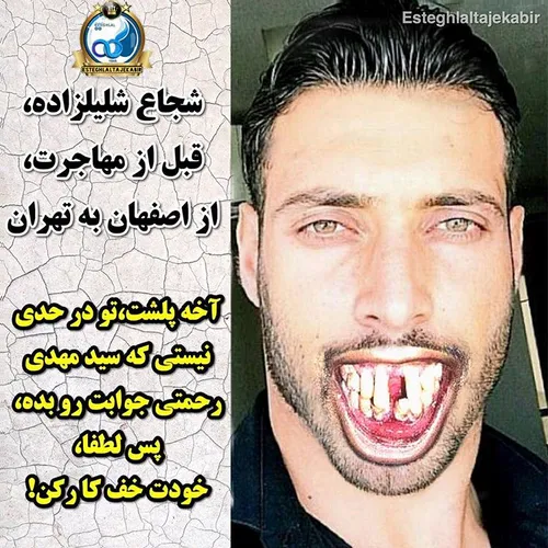 علیل زاده تو سگ کی باشی آخه؟