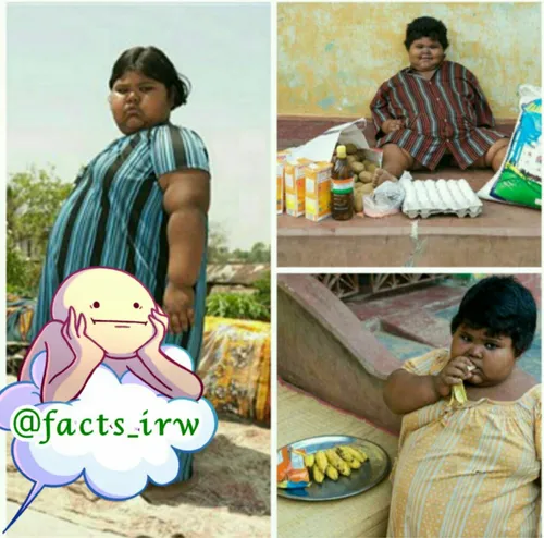 سومن دختر 5 ساله هندی که 75 کیلو وزن دارد و اشتهایی نامحد