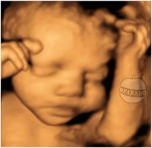 گرفتن سونوگرافی 3 بعدی (3D) از جنین داخل رحم باعث افزایش 