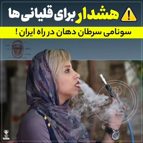 🚨 هشدار برای قلیانی ها، سونامی سرطان دهان در راه ایران !