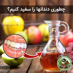 چطوری دندانها را سفید کنیم؟