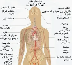 علاٸم کم کاری تیرویید☝ ☝ ☝ ☝