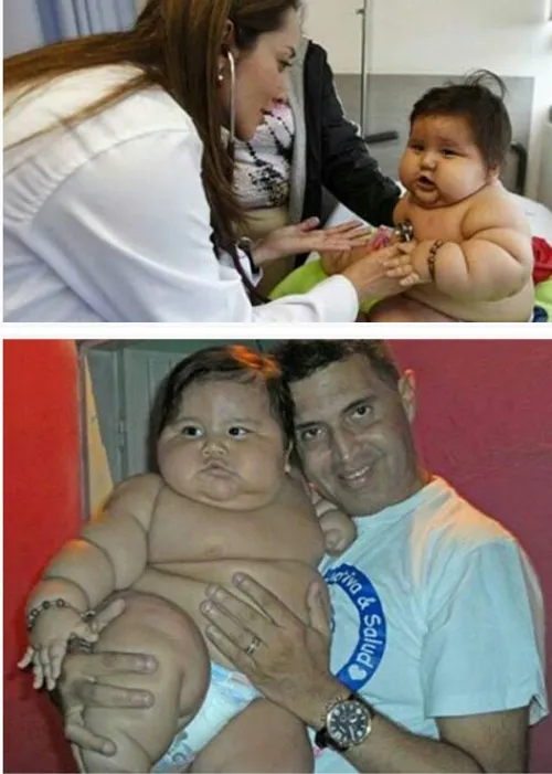 این کودک 20کیلو وزن دارد