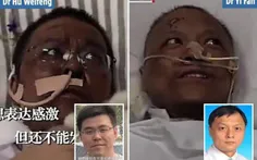 پوست ۲ پزشک چینی مبتلا به کرونا سیاه شد!
