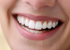 👈  شناسایی بیماری از طریق دهان و دندان !