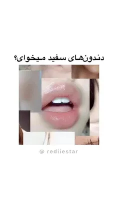 دندون سفید میخوای.. 