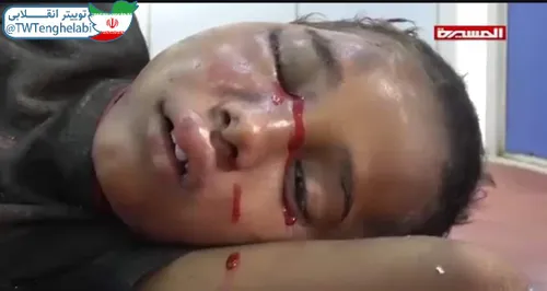 ⭕ ️ بر غَمِ کودکانِ یمن، خون گریه کنیم رواست