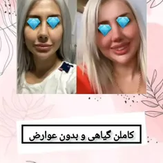 شارژ مجدد پکیج چاقی صورت ✔😋