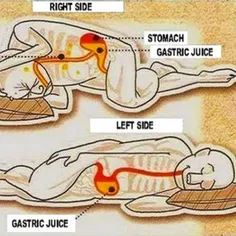 کسانی که شب ها عادت دارند روی قسمت چپ بدن خود بخوابند معم