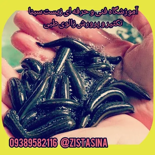 09389582116 @zistsina